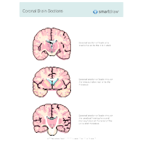 Coronal Brain Sections