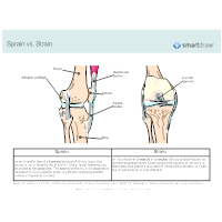 Sprain vs. Strain